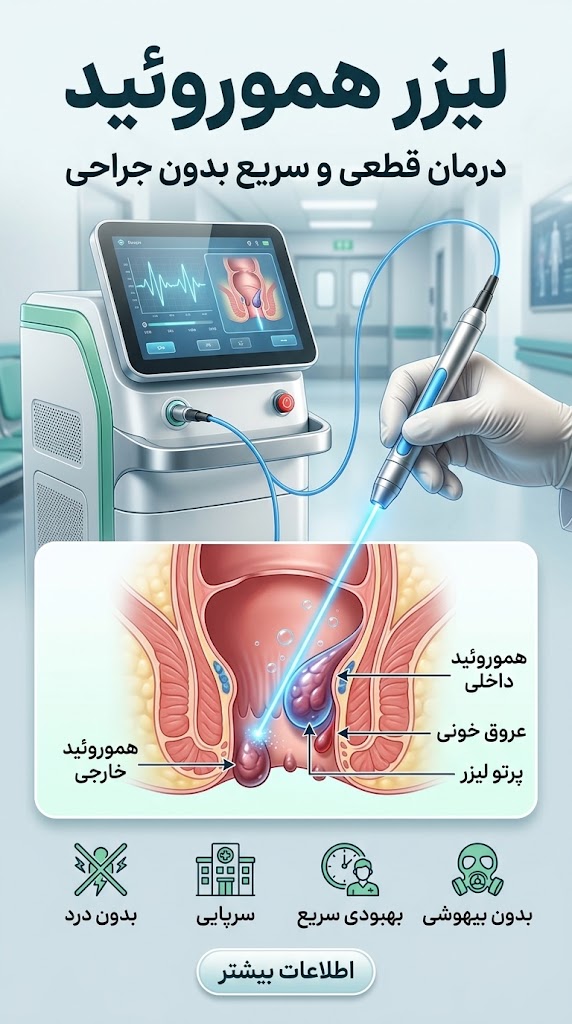 لیزر هموروئید (بواسیر)؛ روش انجام، مزایا، عوارض و هزینه