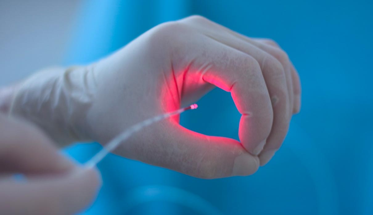 لیزر هموروئید